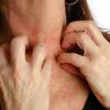 Can Stressing Too Often Lead to Itchiness and Other Skin Issues?